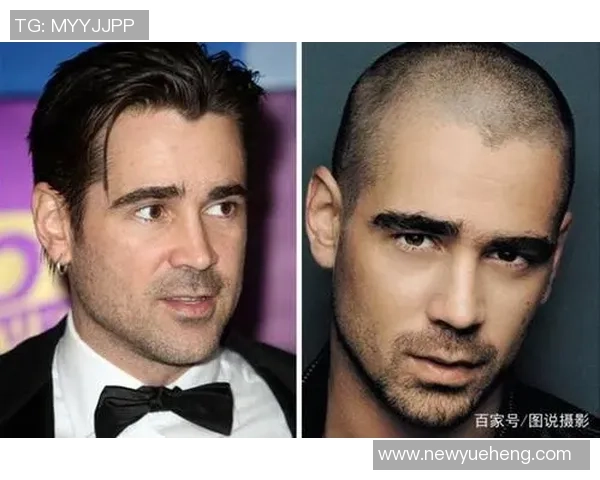 足球球星剃光头背后的原因与影响：从时尚潮流到心理调整的深层解析